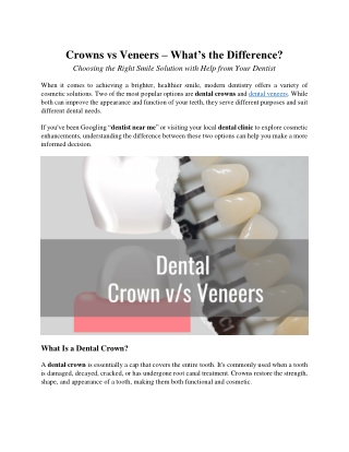 Dental Crowns and Veneers: What are the Differences?