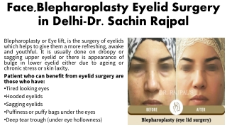Face,Blepharoplasty Eyelid Surgery  in Delhi-Dr. Sachin Rajpal