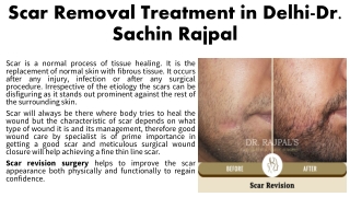 Scar Removal Treatment in Delhi- Dr. Sachin Rajpal