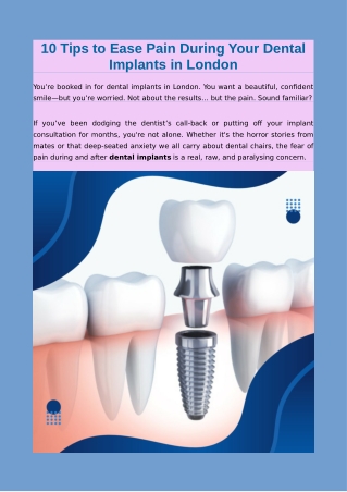 10 Tips to Ease Pain During Your Dental Implants in London
