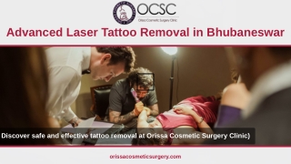 Tattoo Removal in Bhubaneswar