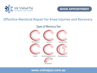 Effective Meniscal Repair for Knee Injuries and Recovery