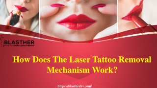 How Does The Laser Tattoo Removal Mechanism Work