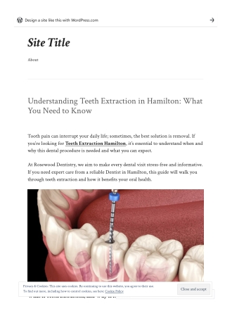Understanding Teeth Extraction in Hamilton: What You Need to Know