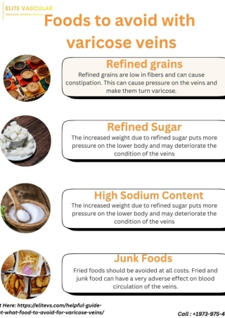 Helpful guide about what food to avoid for varicose veins