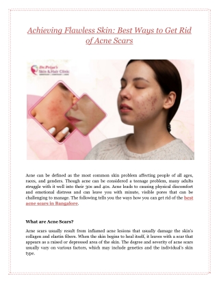 Achieving Flawless Skin: Best Ways to Get Rid of Acne Scars