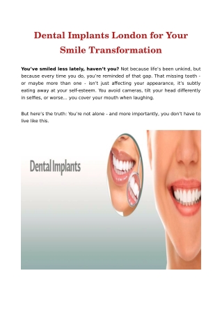 Dental Implants London for Your Smile Transformation