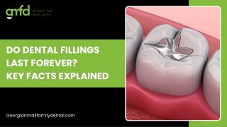 Understanding Dental Fillings: What Lasts and When to Replace