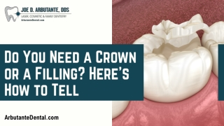 Know When You Need A Dental Crown Or A Filling