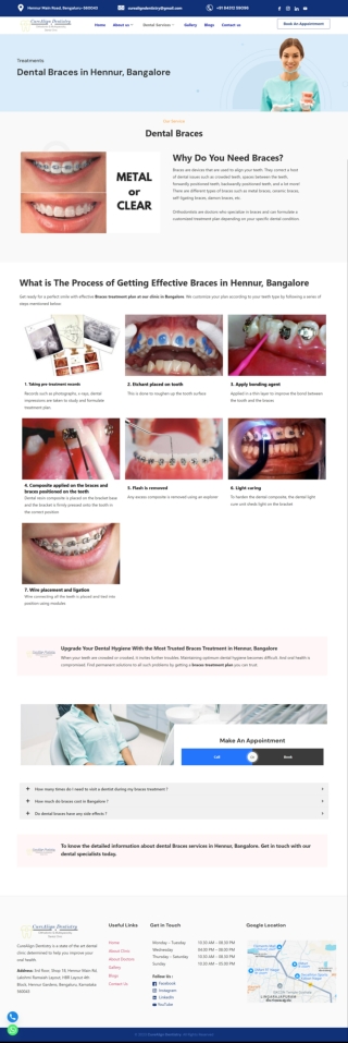 Dental-Braces-in-Hennur-Bangalore-CureAlign-Dentistry