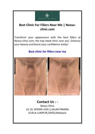Best Clinic For Fillers Near Me  Nexus-clinic.com