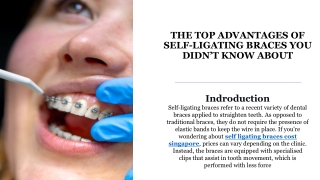 The Top Advantages of Self-Ligating Braces You Didn’t Know About