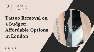 Tattoo Removal on a Budget Affordable Options in London