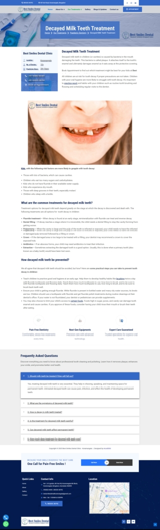 Decayed-Milk-Teeth-Treatment-in-Koramangala-Bengaluru