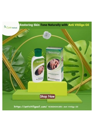 Restoring Skin Tone Naturally With Anti Vitiligo Oil