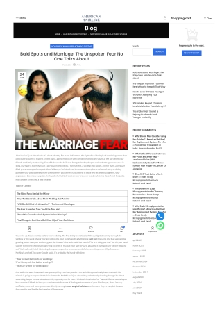 Bald Spots and Marriage: The Unspoken Fear No One Talks About