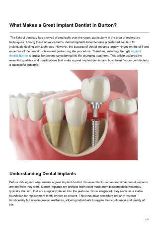 What Makes a Great Implant Dentist in Burton