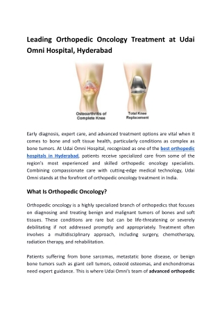 Leading Orthopedic Oncology Treatment at Udai Omni Hospital, Hyderabad