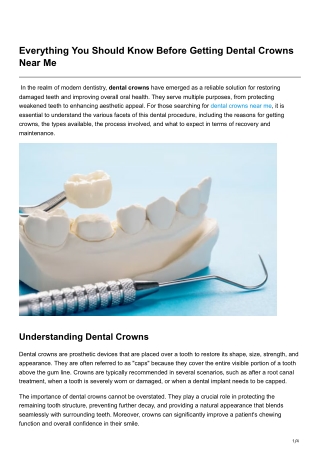 Everything You Should Know Before Getting Dental Crowns Near Me