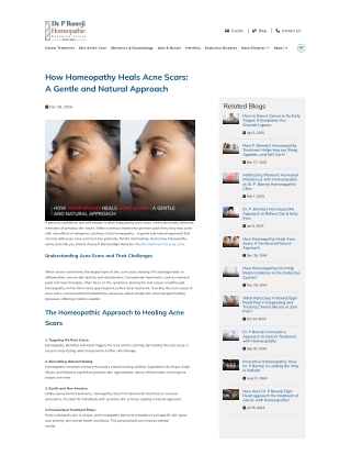 How Homeopathy Heals Acne Scars A Gentle and Natural Approach