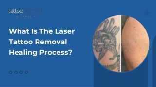 What Is The Laser Tattoo Removal Healing Process