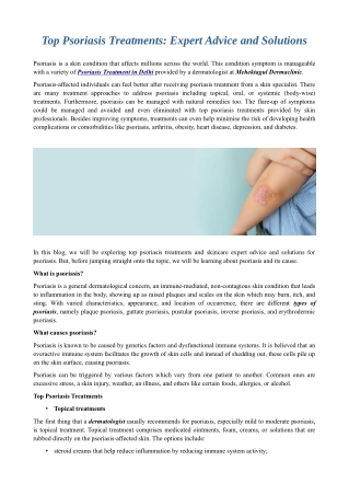 Top Psoriasis Treatments: Expert Advice and Solutions