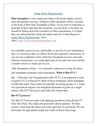 Scalp Micro Pigmentation