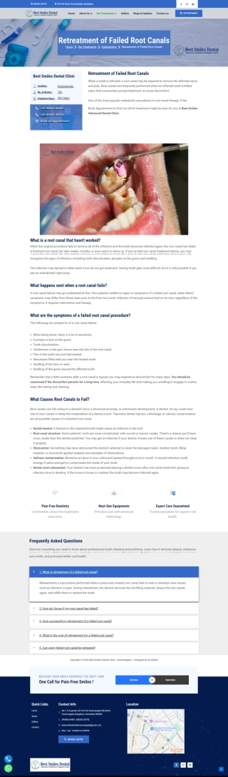 Retreatment of Failed Root Canals in Koramangala, Bengaluru
