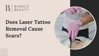 Does Laser Tattoo Removal Cause Scars