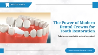 Beyond the Cap: Unveiling Power of Modern Dental Crowns for Tooth Restoration.