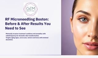 RF Microneedling Boston Before & After Results You Need to See
