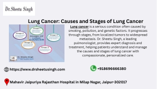 Lung Cancer Causes and Stages of Lung Cancer