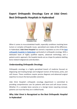 Expert Orthopedic Oncology Care at Udai Omni_ Best Orthopedic Hospitals in Hyderabad