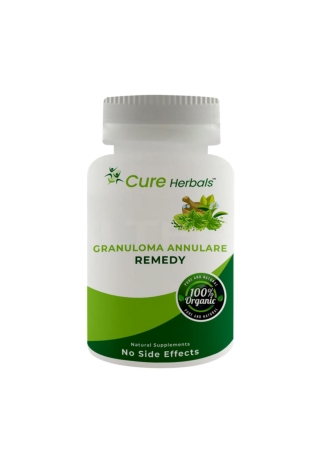 Granuloma Annulare Herbal Supplements