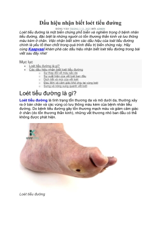 Dấu hiệu nhận biết loét tiểu đường