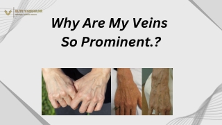 Why Are My Veins  So Prominent.?