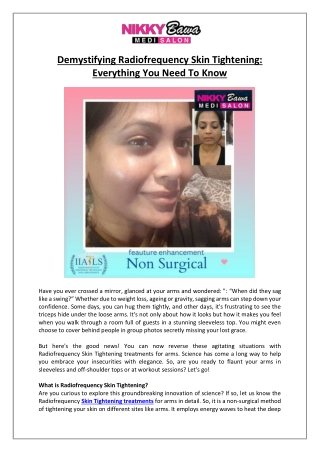 Aesthetica by Nikky Bawa Medisalon - Radiofrequency Skin Tightening Overview