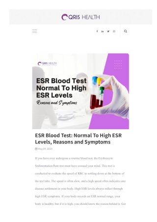 Cost of ESR Test A Key Inflammation Marker