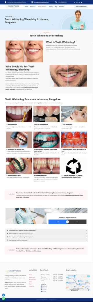 Teeth Whitening Bleaching in Hennur Bangalore CureAlign