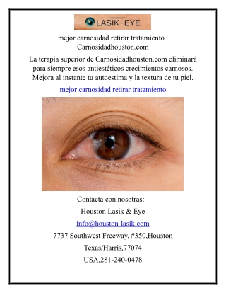 mejor carnosidad retirar tratamiento  Carnosidadhouston.com