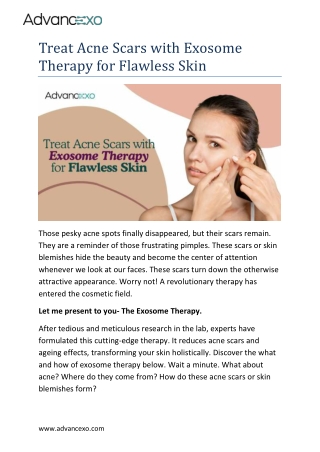 Treat Acne Scars with Exosome Therapy for Flawless Skin