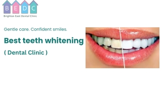 Best teeth whitening -BEDC