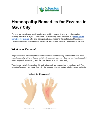 Homeopathy Remedies for Eczema in Gaur City
