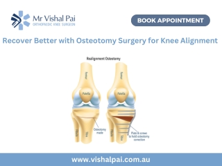 Recover Better with Osteotomy Surgery for Knee Alignment