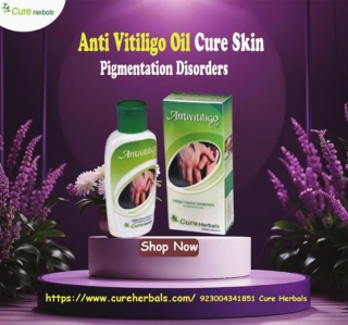 Can Anti Vitiligo Oil Cure Skin Pigmentation Disorders