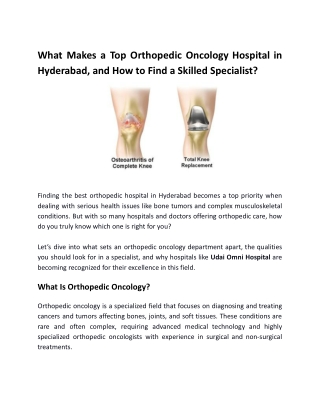 What Makes a Top Orthopedic Oncology Hospital in Hyderabad?