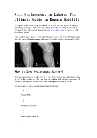Knee Replacement Lahore_Your Guide to Mobility
