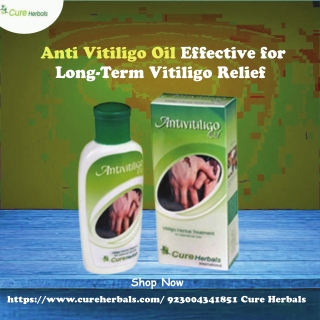 Is Anti Vitiligo Oil Effective for Long-Term Vitiligo Relief?