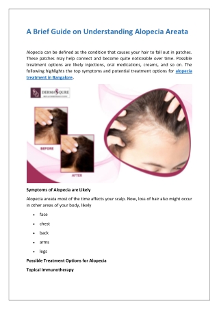A Brief Guide on Understanding Alopecia Areata
