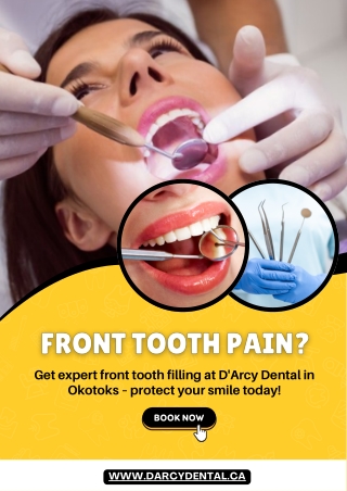 Front Tooth Filling in Okotoks for Lasting Relief